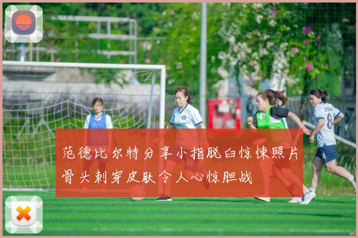 范德比尔特分享小指脱臼惊悚照片骨头刺穿皮肤令人心惊胆战